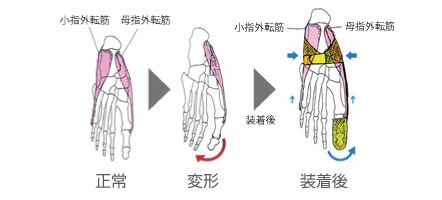 装着前後骨