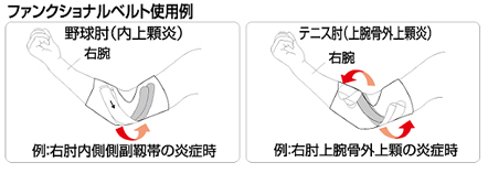 ファンクションエルボープロ