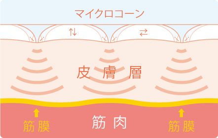 ソマセプトミオ