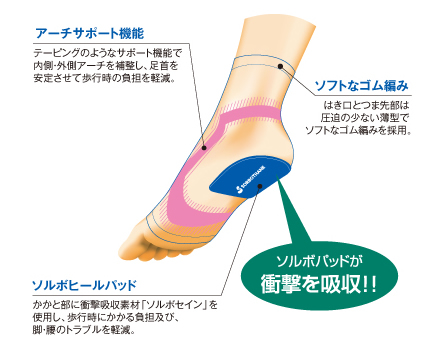 アーチサポートの詳細