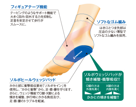 スパイラルウェッジの詳細