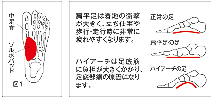 タテアーチサポーターの詳細