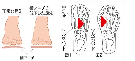 ヨコアーチサポーターの詳細